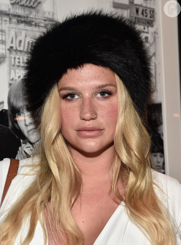 A cantora Kesha tem o rosto repleto de sardas e não faz questão de escondê-las