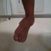 Kiko Pissolato postou foto do pé quebrado e assustou fãs