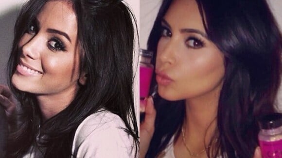 Anitta pediu para ficar parecida com Kim Kardashian antes de cirurgia plástica