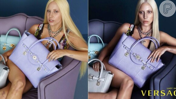 Lady Gaga aparece sem maquiagem e com hematomas em fotos não tratadas da campanha da Versace, em 16 de abril de 2014
