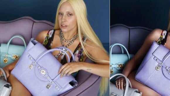Lady Gaga aparece com hematomas em fotos não tratadas da campanha da Versace