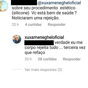 Xuxa Meneghel tranquilizou os fãs no Instagram sobre a cirurgia que foi submetida para trocar as próteses de silicone