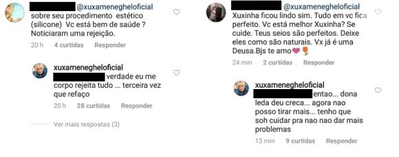 Xuxa Meneghel tranquilizou os fãs no Instagram sobre a cirurgia que foi submetida para trocar as próteses de silicone