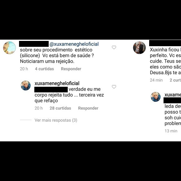 Xuxa Meneghel tranquilizou os fãs no Instagram sobre a cirurgia que foi submetida para trocar as próteses de silicone
