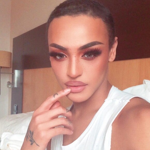 Pabllo Vittar explicou como o acidente aconteceu em seu Instagram Stories