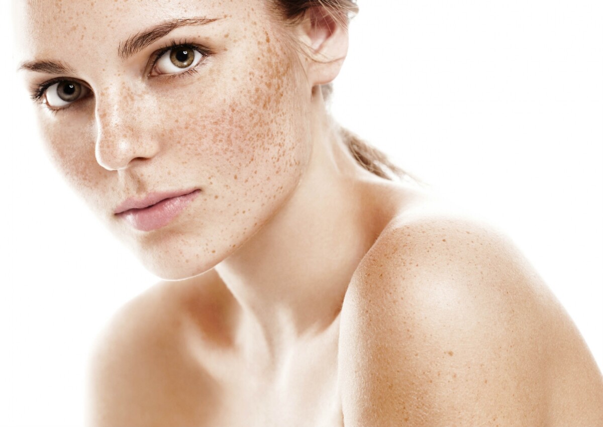 Maquiagem para pele com sardas: aprenda a realçar ou a 'disfarçar' com  dicas e bases especiais