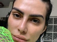 Sem make, Cleo exibe beleza natural em foto e fã elogia: 'Tem melasma e assume'