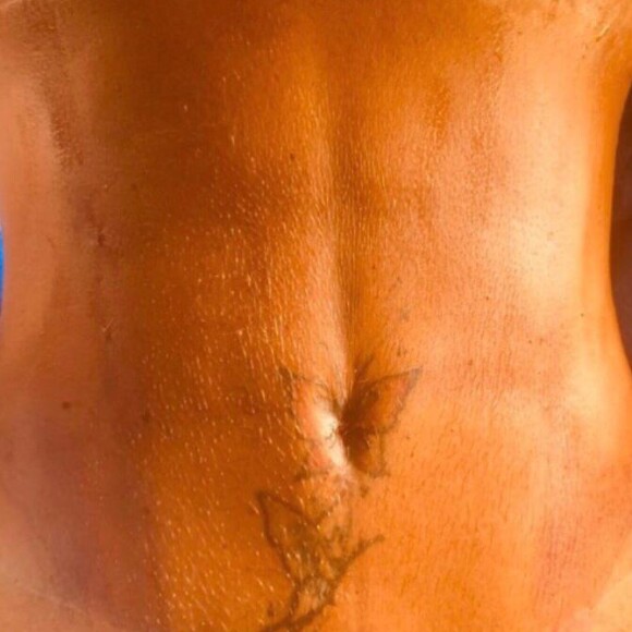 Gretchen realizou uma lipoaspiração de alta definição (LAD)