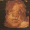 Carol Dantas mostrou rosto do filho, Valentin, em novo ultrassom: 'Bebê gorduxo'