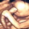 Grávida do primeiro filho, Giselle Itié compartilhou foto do ultrassom do seu bebê