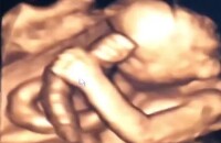 Grávida do primeiro filho, Giselle Itié compartilhou foto do ultrassom do seu bebê