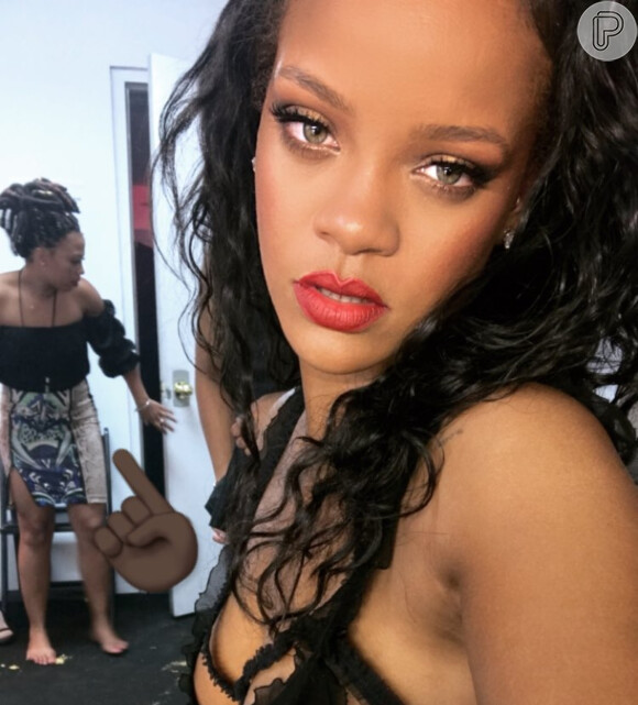 Assessoria de Rihanna revela hematomas após acidente: 'Machucou testa e rosto'