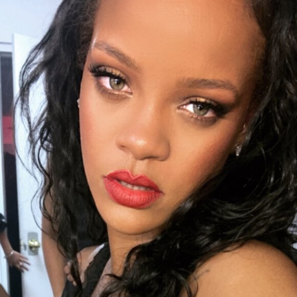 Assessoria de Rihanna revela hematomas após acidente: 'Machucou testa e rosto'