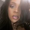 Rihanna preocupou fãs ao ser flagrada ferida