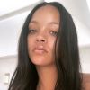 Rihanna foi clicada com olho inchado e ferimentos na testa em estacionamento de restaurante nos Estados Unidos