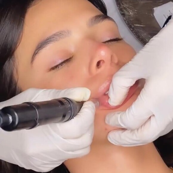 Bruna Marquezine escolheu para iniciar o procedimento estético Hidragloss na Loveena Clinic, localizada em São Paulo