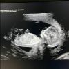 Whindersson Nunes dividiu foto do ultrassom do primeiro filho, João Miguel, com seus fãs nas redes sociais