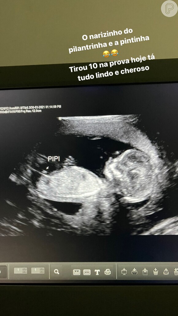 Whindersson Nunes dividiu foto do ultrassom do primeiro filho, João Miguel, com seus fãs nas redes sociais