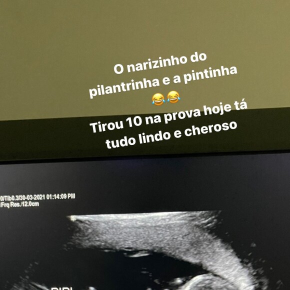 Whindersson Nunes mostra ultrassom do filho e brinca: 'Tirou 10 na prova'