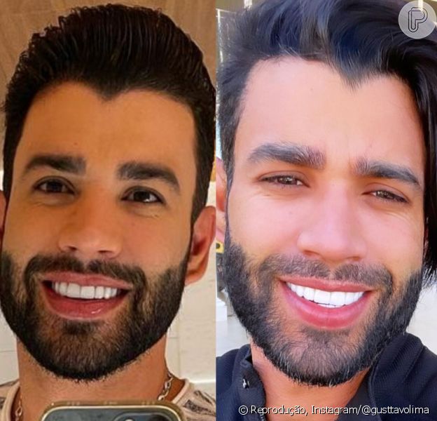 Cabelo de Gusttavo Lima: cantor retoma visual curto após comparações na web