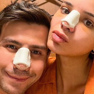 O cantor Mariano e a namorada, Jakelyne Oliveira, se submeteram à rinoplastia no mesmo dia