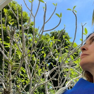 Fátima Bernardes deu detalhes sobre a recuperação do ombro, operado em outubro