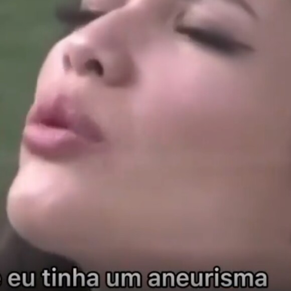 Juliette contou tido um aneurisma, uma alteração em vaso sanguíneo, veia ou artéria, do corpo