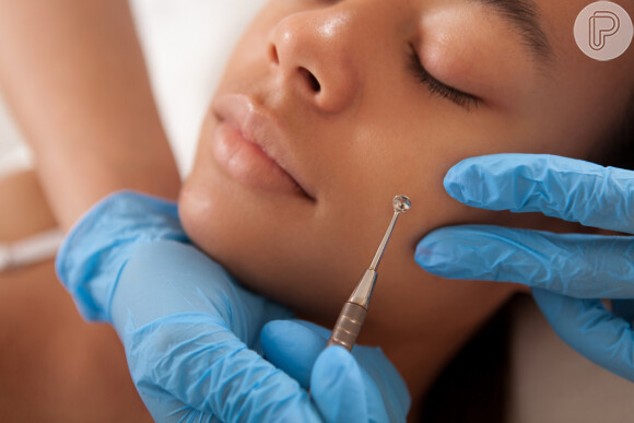 Limpeza de pele auxilia na remoção de cravos e comedões, além de amenizar acne
