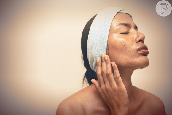 Acne pode ser amenizada com uma limpeza de pele realizada por profissional