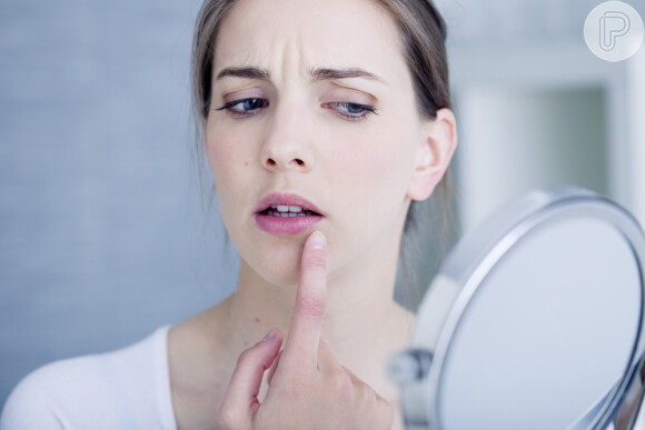 A herpes labial não tem cura, mas pode ser tratada para evitar lesões na boca