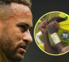 A Seleção Brasileira estreou na Copa do Mundo com vitória, mas com um desfalque de uma peça importante para o time: Neymar