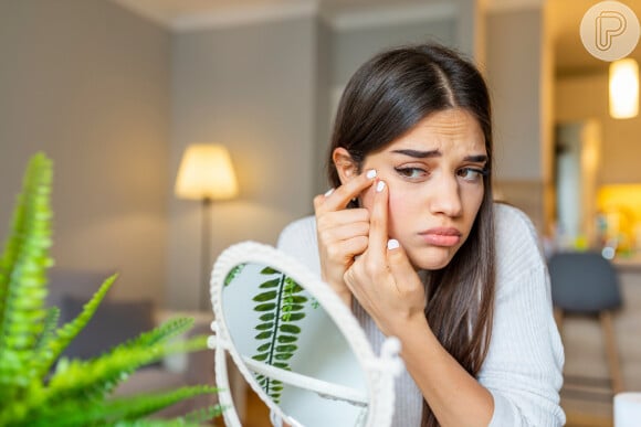 Cuidar da pele com acne é um desafio: usar pasta de dente não deve ser uma alternativa, pontua dermatologista