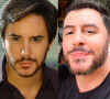Comparativo mostra antes e depois de rosto de Ricardo Tozzi