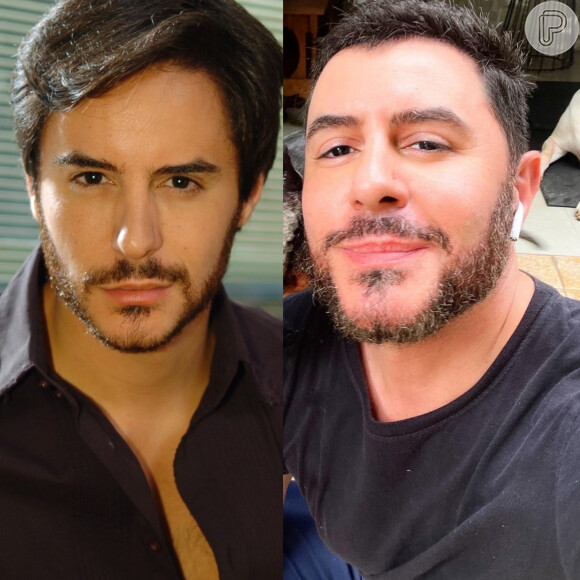 Comparativo mostra antes e depois de rosto de Ricardo Tozzi