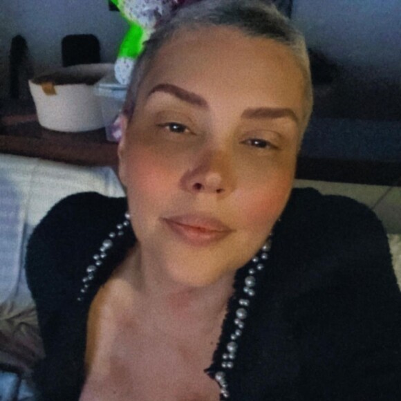 Simony e a luta contra o câncer: 'Depois do CA, descobri o quanto é maravilhoso uma vida real e sem filtro. Se ame. Um dia de cada vez'