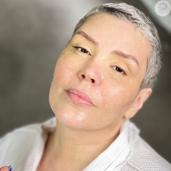 Simony sem maquiagem: a cantora aproveitou o registro para fazer uma reflexão sobre uma vida mais real após a doença