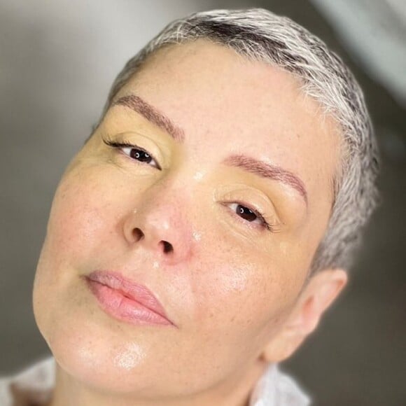 Simony sem maquiagem: a cantora aproveitou o registro para fazer uma reflexão sobre uma vida mais real após a doença