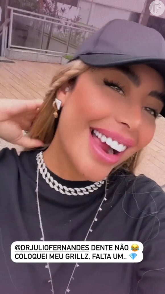 Grillz Rafaella Santos Aposta Na Tendência Das Joias Nos Dentes E