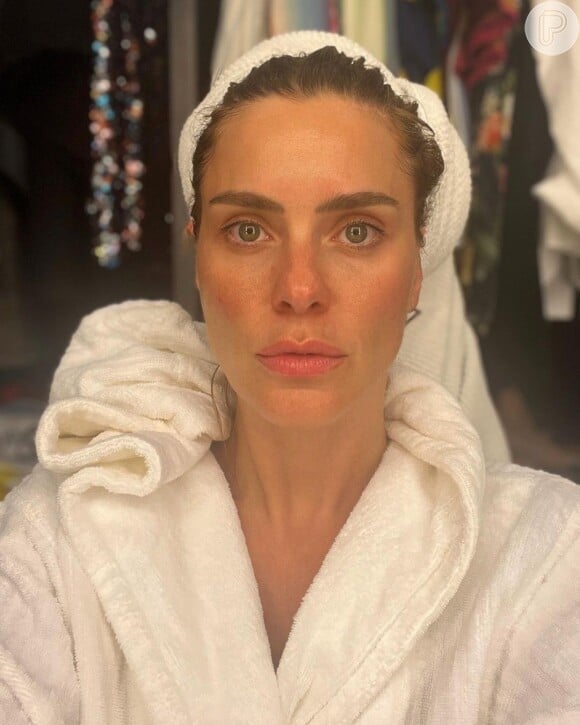 Sem Filtro E Sem Make Carolina Dieckmann Ganha Chuva De Elogios Por Beleza Natural