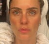 'Sem filtro e sem make', Carolina Dieckmann ganha chuva de elogios por beleza natural: 'Hipnotizada'