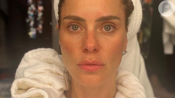 'Sem filtro e sem make', Carolina Dieckmann ganha chuva de elogios por beleza natural: 'Hipnotizada'