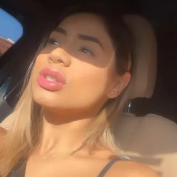 Lexa fez preenchimento labial? Boca da cantora chamou atenção em vídeo