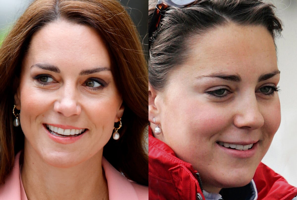 foto antes e depois de kate middleton surpreende por mudança nas