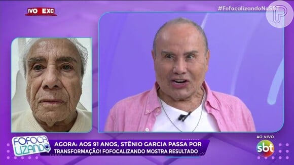 Stenio Garcia é internado um mês após passar por harmonização facial