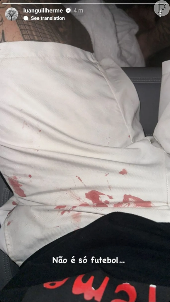 Luan postou uma foto com as roupas sujas de sangue