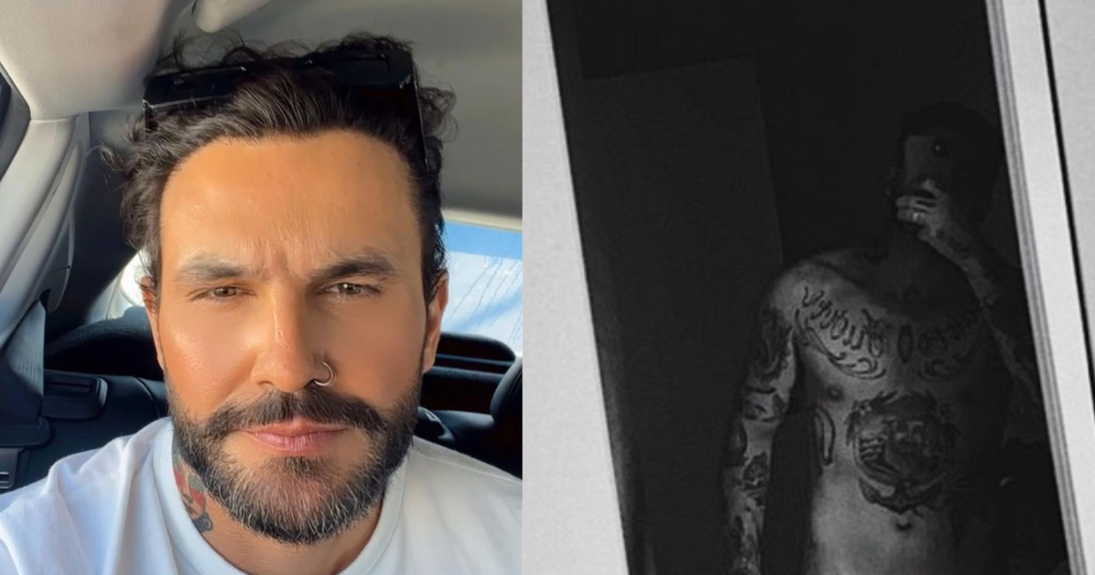 Harmonização peniana: ex-'BBB' Wagner mostra antes e depois do ...