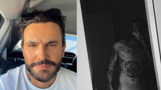 Harmonização peniana: ex-'BBB' Wagner mostra antes e depois do procedimento e doutor entrega quantos cm pode crescer