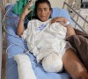 MC Katia precisou amputar a perna após uma trombose
