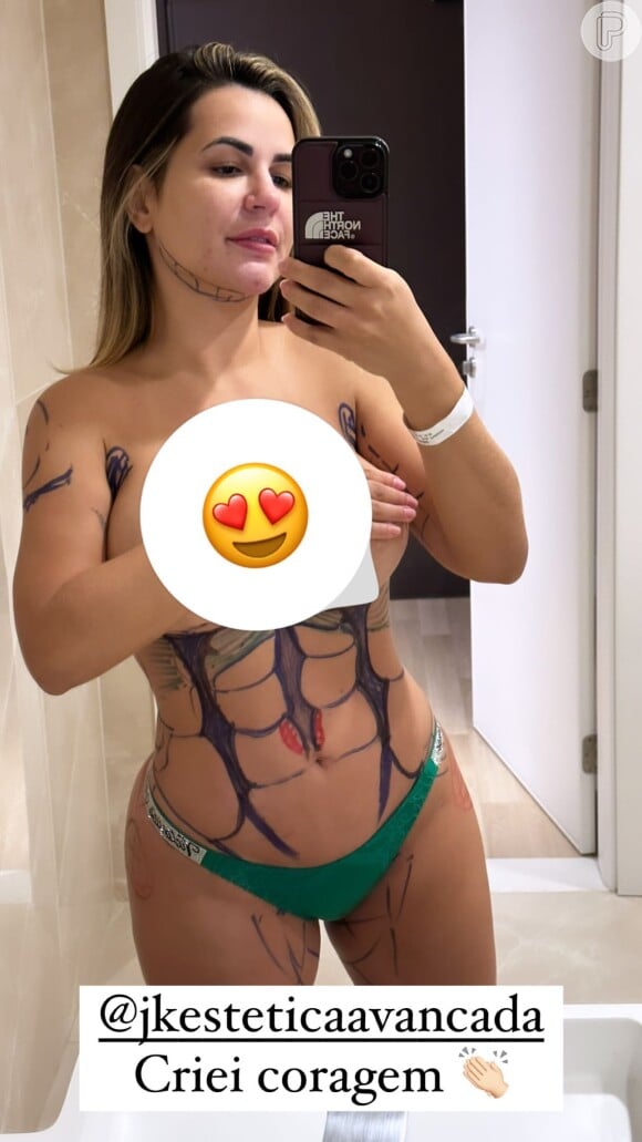 Deolane Bezerra mostrou corpo antes de se submter a uma lipo LAD