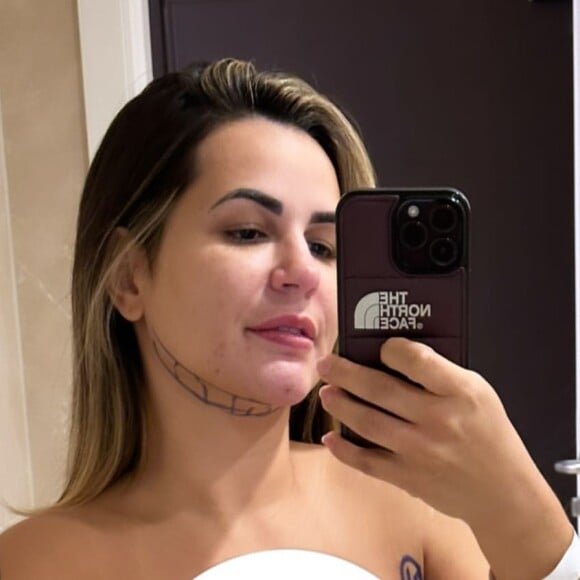 Deolane Bezerra mostrou corpo antes de se submter a uma lipo LAD